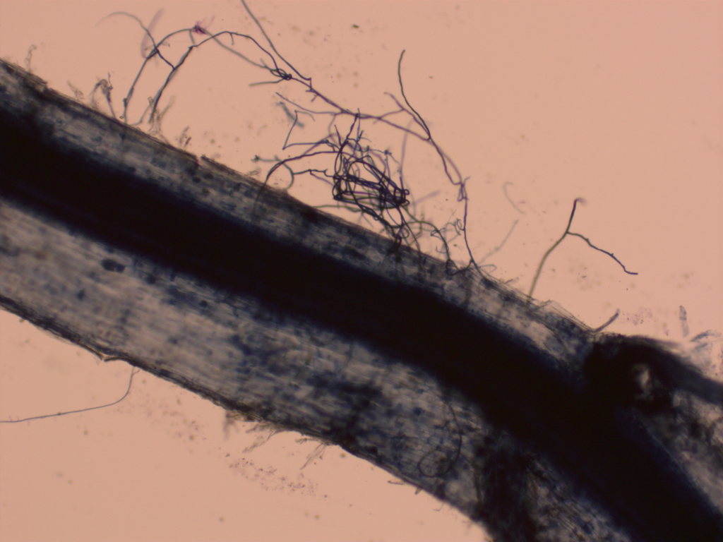 Microscope image of black mycorrhizal hyphae inside a flax root and spreading out from the root surface